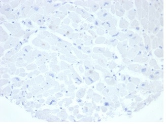 Alkaline Phosphatase (Placental)/PLAP (Germ Cell Tumor Marker) Antibody in Immunohistochemistry (Paraffin) (IHC (P))