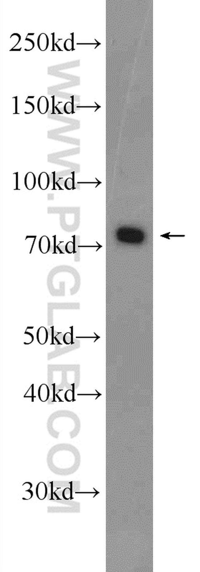 HCLS1 Antibody in Western Blot (WB)