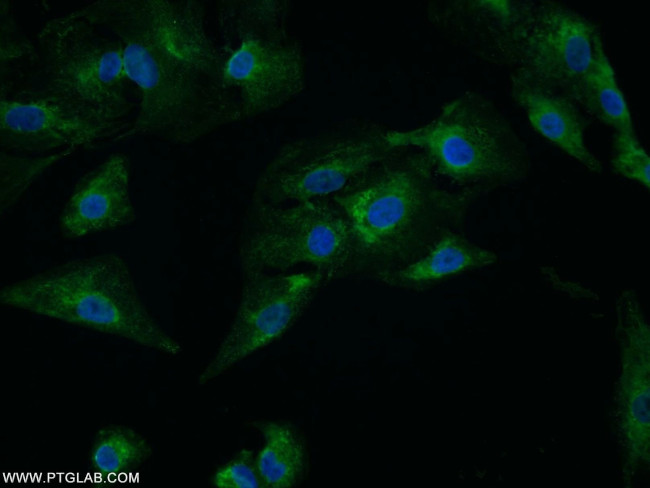 C4orf29 Antibody in Immunocytochemistry (ICC/IF)