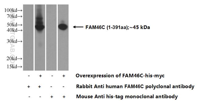 FAM46C Antibody in Western Blot (WB)