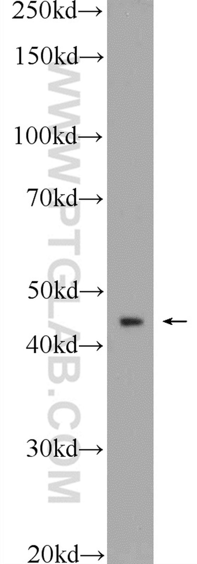 HOXA2 Antibody in Western Blot (WB)