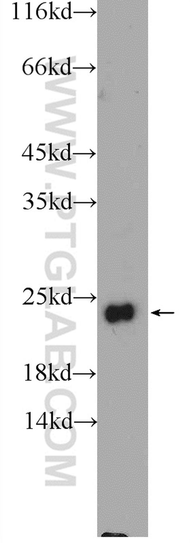 FEV Antibody in Western Blot (WB)