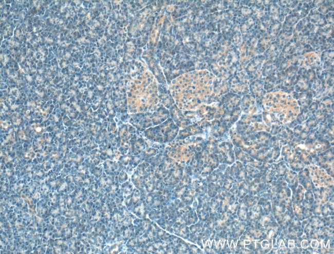 SIPA1L1 Antibody in Immunohistochemistry (Paraffin) (IHC (P))