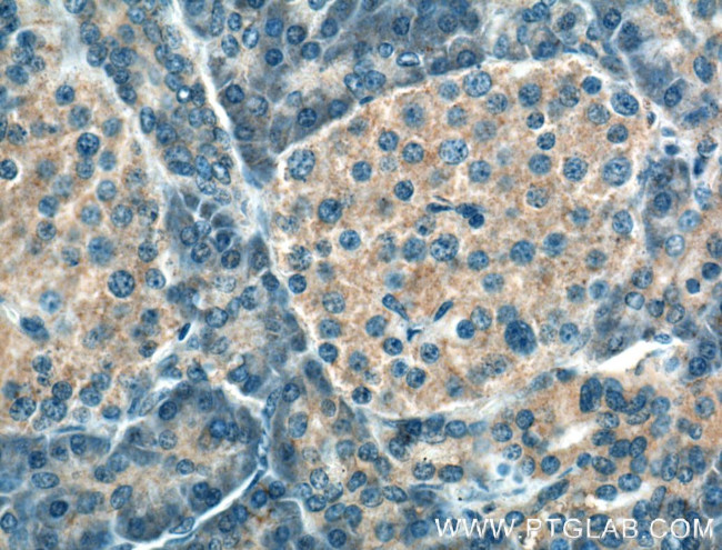 SIPA1L1 Antibody in Immunohistochemistry (Paraffin) (IHC (P))