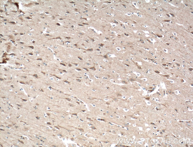 SIPA1L1 Antibody in Immunohistochemistry (Paraffin) (IHC (P))