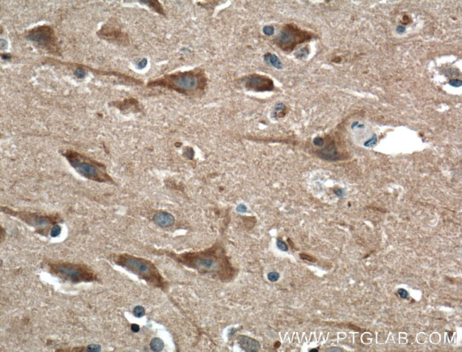 SIPA1L1 Antibody in Immunohistochemistry (Paraffin) (IHC (P))