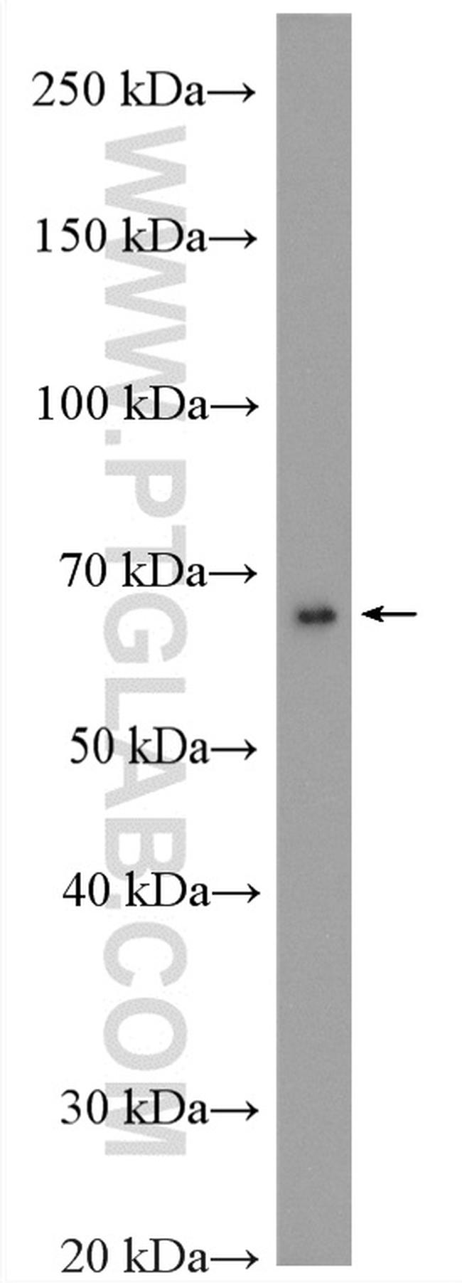 BTNL2 Antibody in Western Blot (WB)