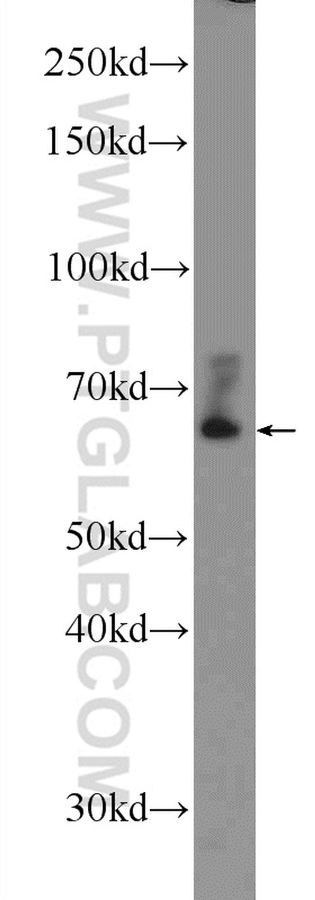 BTNL2 Antibody in Western Blot (WB)