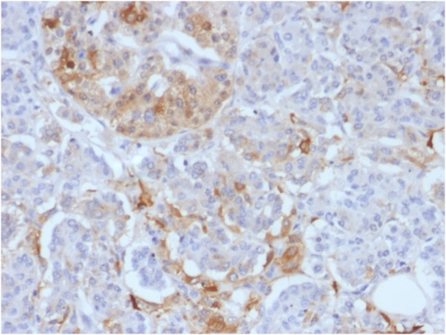 Ferritin, Light Chain Antibody in Immunohistochemistry (Paraffin) (IHC (P))