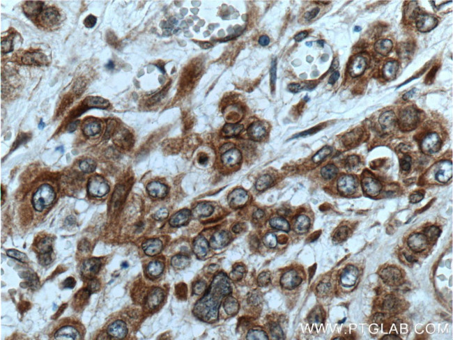 UBAC2 Antibody in Immunohistochemistry (Paraffin) (IHC (P))