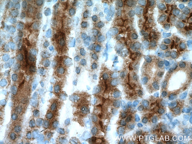 AQP7 Antibody in Immunohistochemistry (Paraffin) (IHC (P))