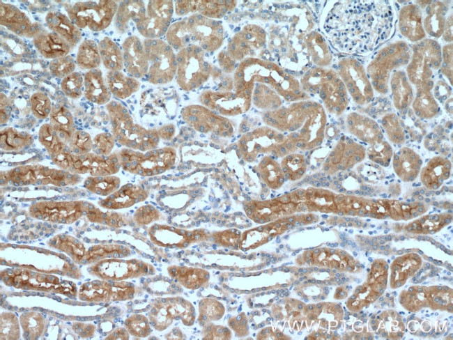 AQP7 Antibody in Immunohistochemistry (Paraffin) (IHC (P))