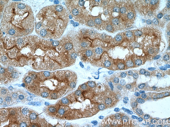 AQP7 Antibody in Immunohistochemistry (Paraffin) (IHC (P))