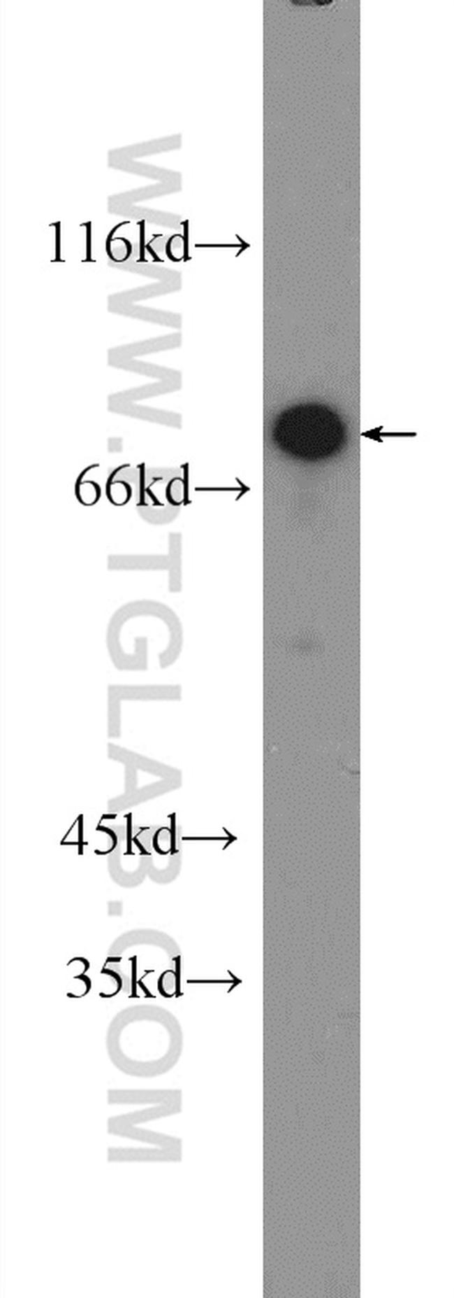 ZNF326 Antibody in Western Blot (WB)