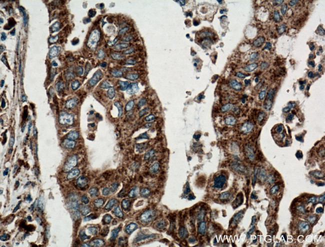 ATG2B Antibody in Immunohistochemistry (Paraffin) (IHC (P))