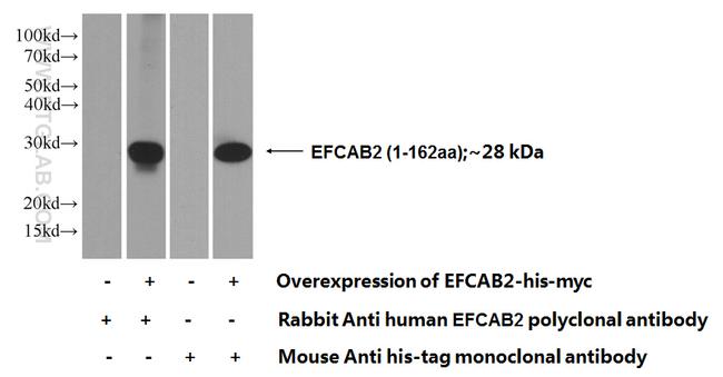 EFCAB2 Antibody in Western Blot (WB)