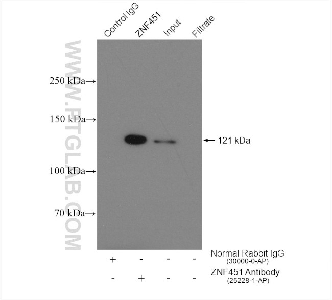 ZNF451 Antibody in Immunoprecipitation (IP)