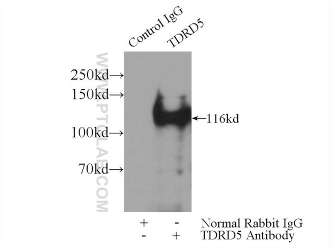 TDRD5 Antibody in Immunoprecipitation (IP)