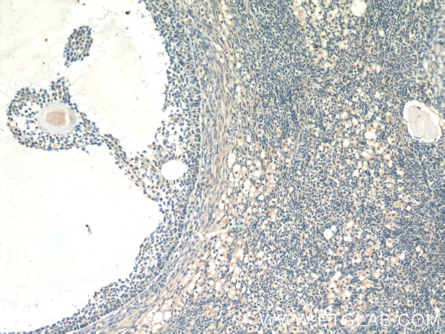 FAM20A Antibody in Immunohistochemistry (Paraffin) (IHC (P))