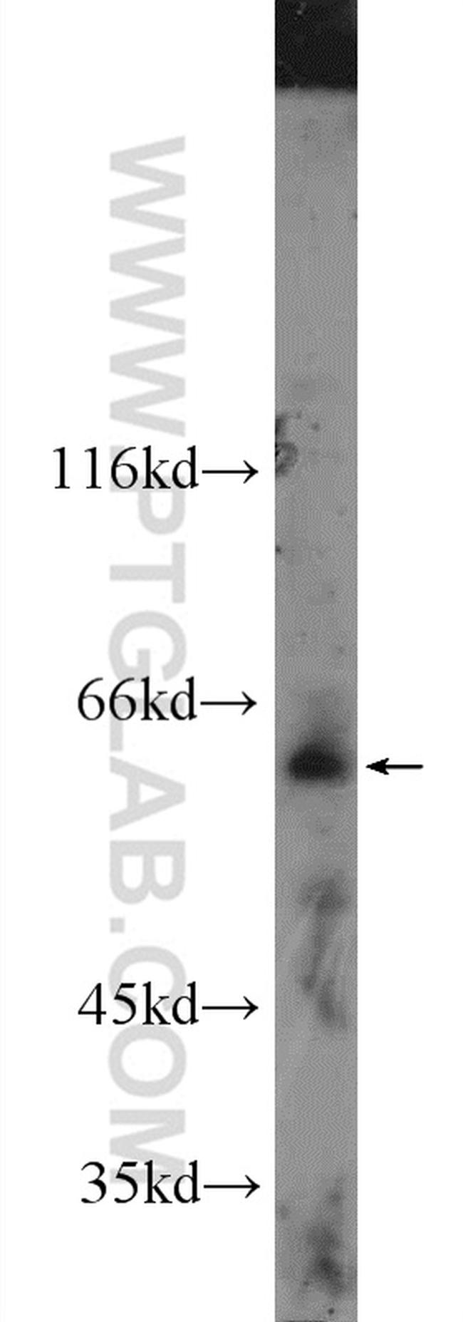 FAM20A Antibody in Western Blot (WB)