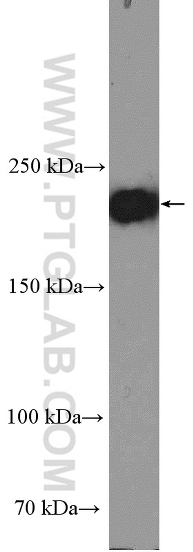 Integrin beta-4 Antibody in Western Blot (WB)