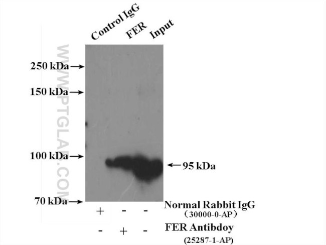 FER Antibody in Immunoprecipitation (IP)
