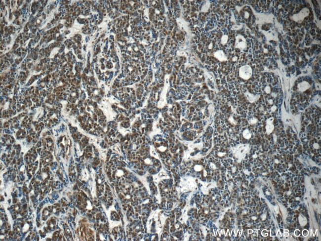 RBM25 Antibody in Immunohistochemistry (Paraffin) (IHC (P))