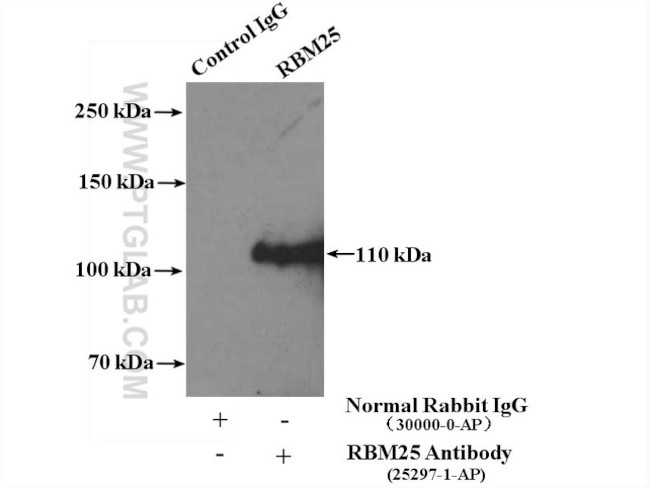 RBM25 Antibody in Immunoprecipitation (IP)