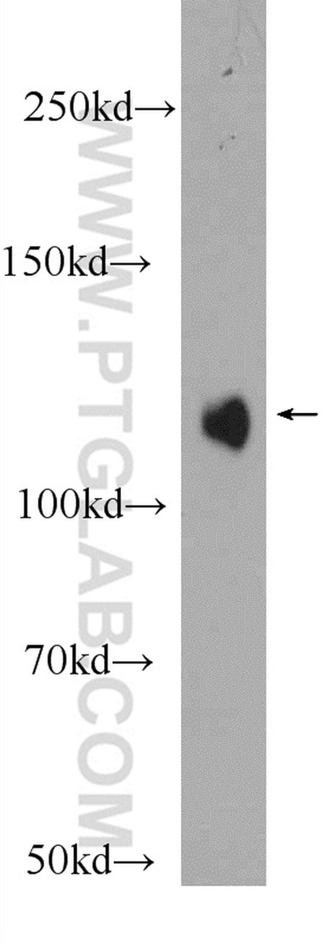 RBM25 Antibody in Western Blot (WB)