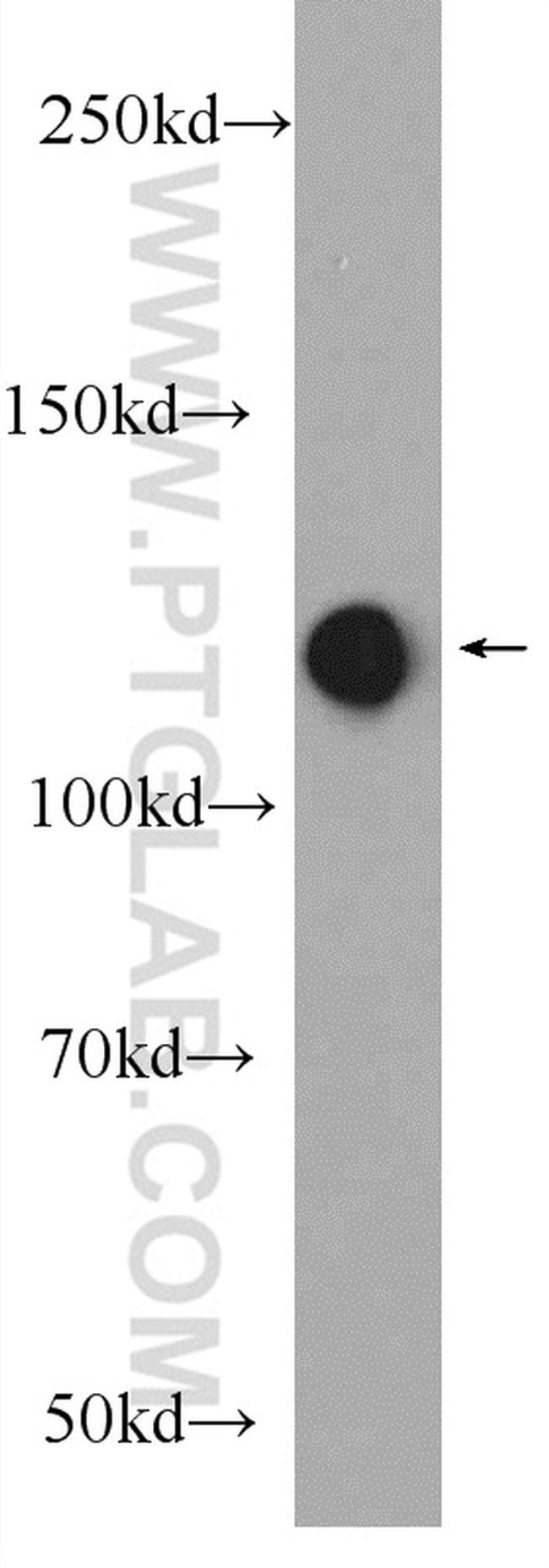 RBM25 Antibody in Western Blot (WB)