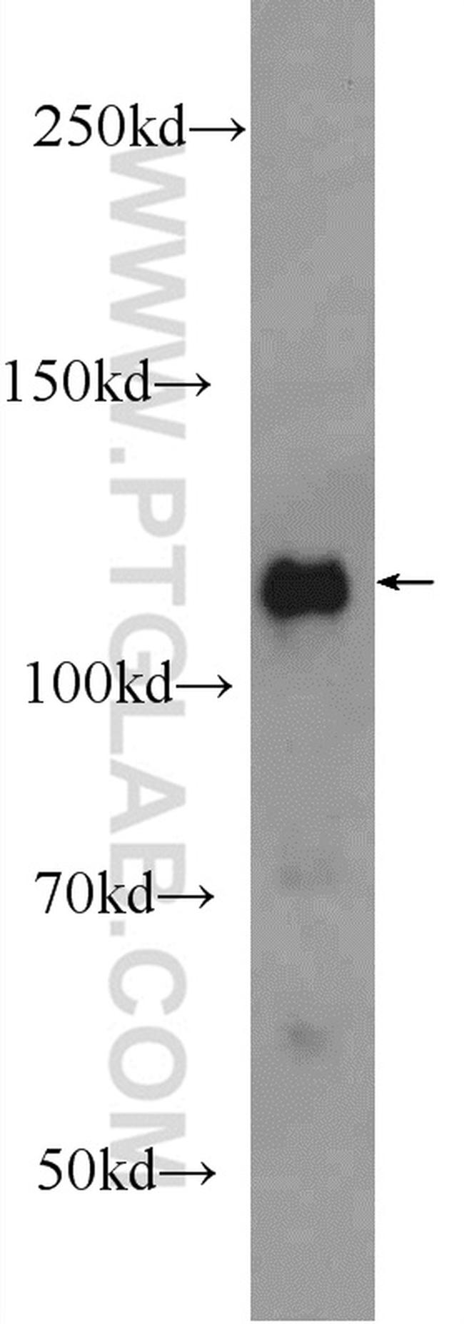 RBM25 Antibody in Western Blot (WB)