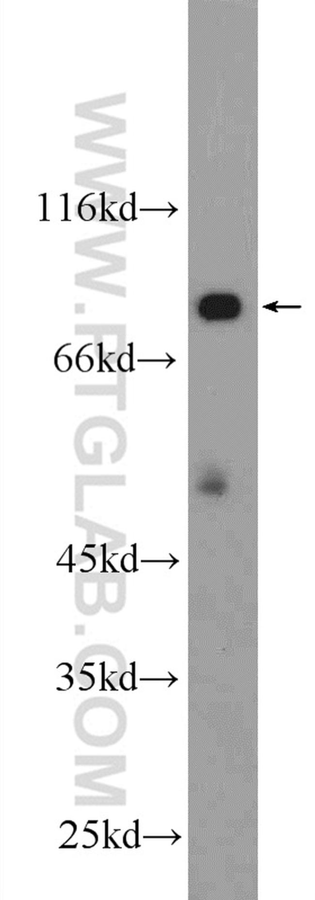 HECTD2 Antibody in Western Blot (WB)