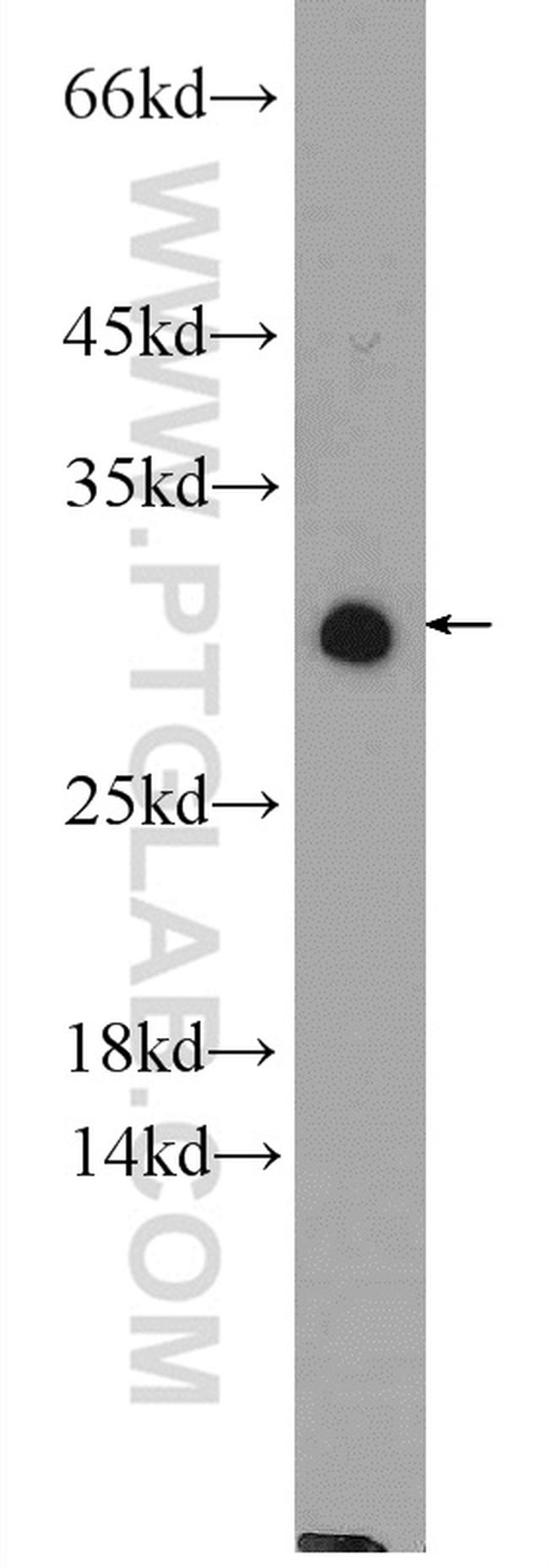 NUP62CL Antibody in Western Blot (WB)
