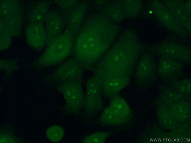 RRP36 Antibody in Immunocytochemistry (ICC/IF)