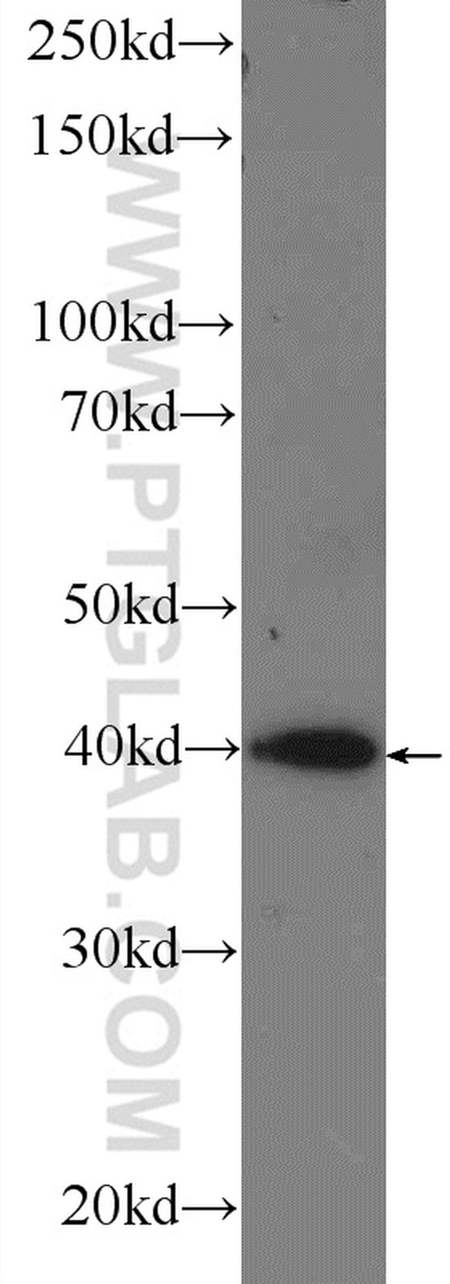 RRP36 Antibody in Western Blot (WB)