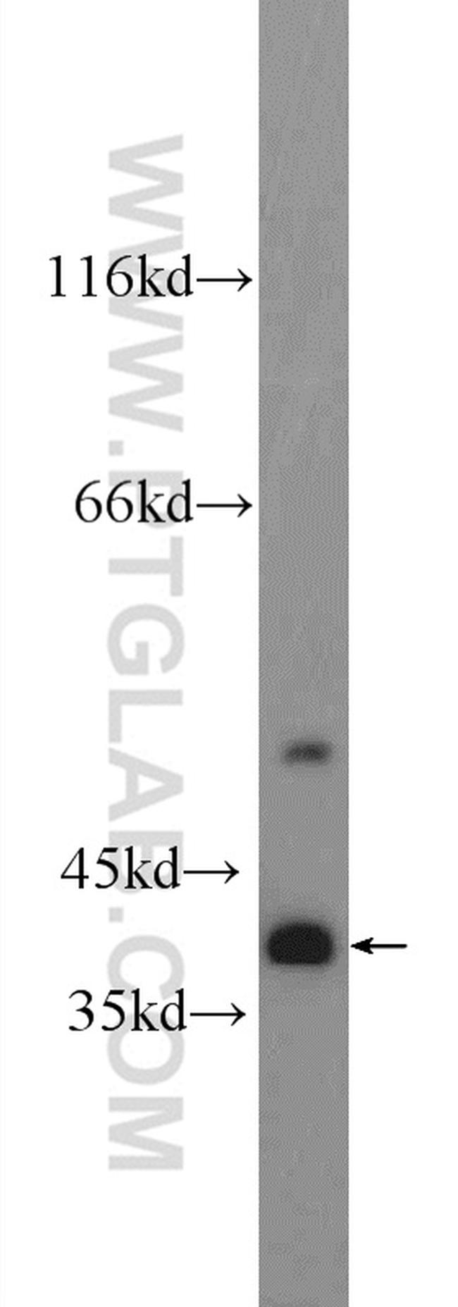 TTC35 Antibody in Western Blot (WB)