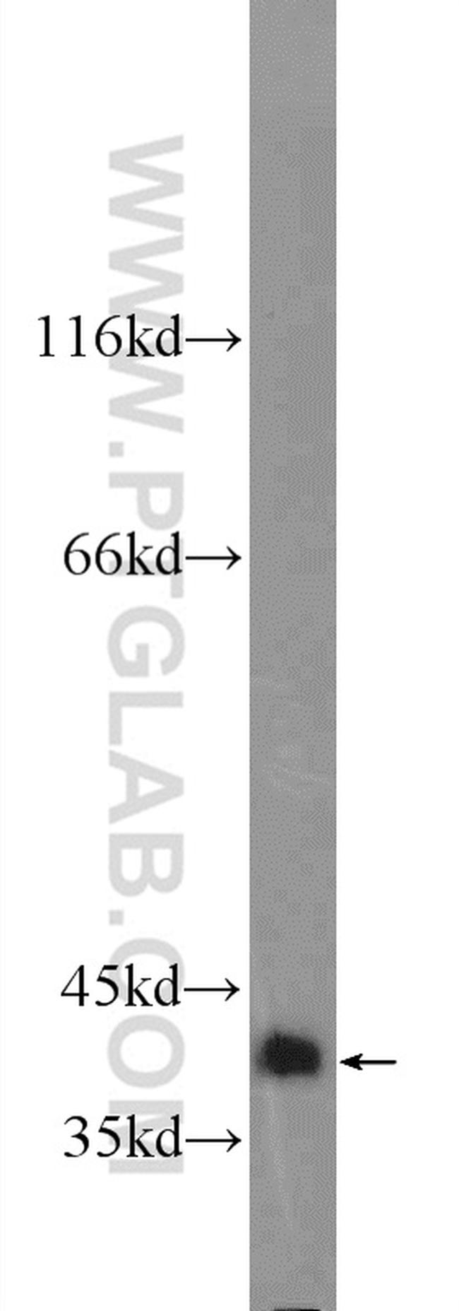 TTC35 Antibody in Western Blot (WB)