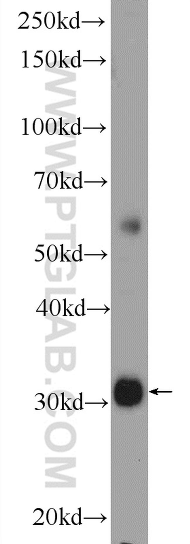 TTC35 Antibody in Western Blot (WB)