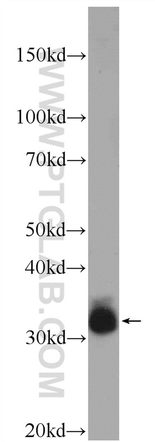 TTC35 Antibody in Western Blot (WB)