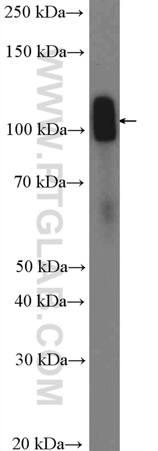 Myopodin Antibody in Western Blot (WB)