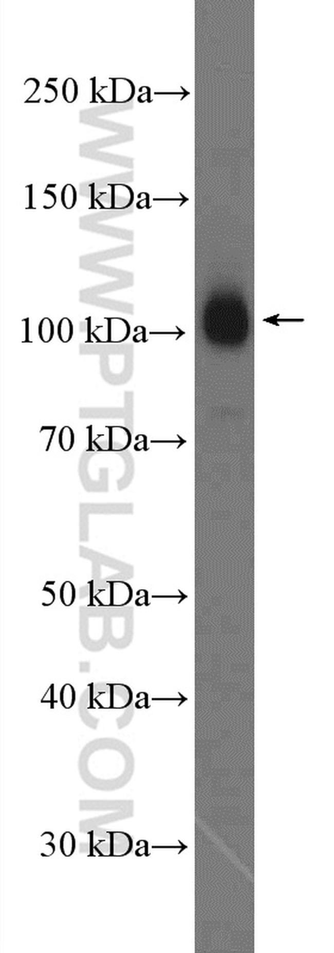 Myopodin Antibody in Western Blot (WB)