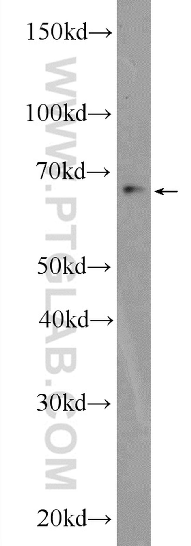 ZBTB46 Antibody in Western Blot (WB)