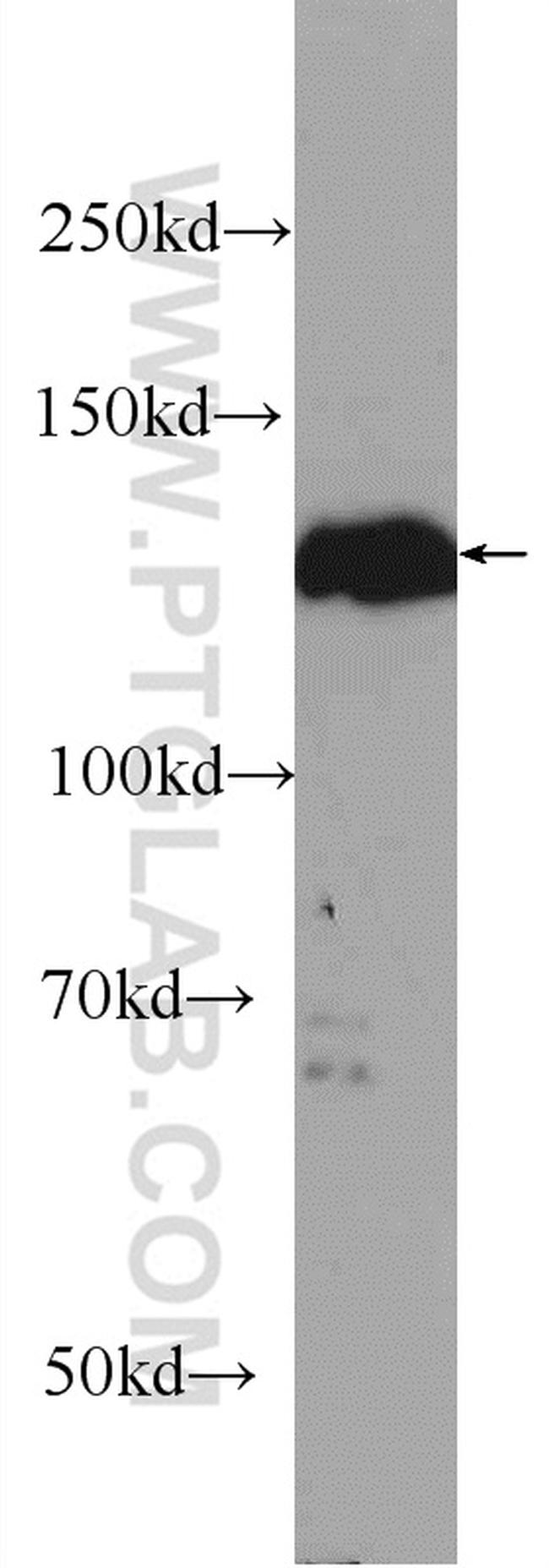 STK10 Antibody in Western Blot (WB)