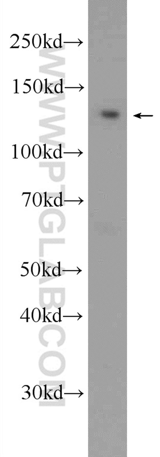 STK10 Antibody in Western Blot (WB)