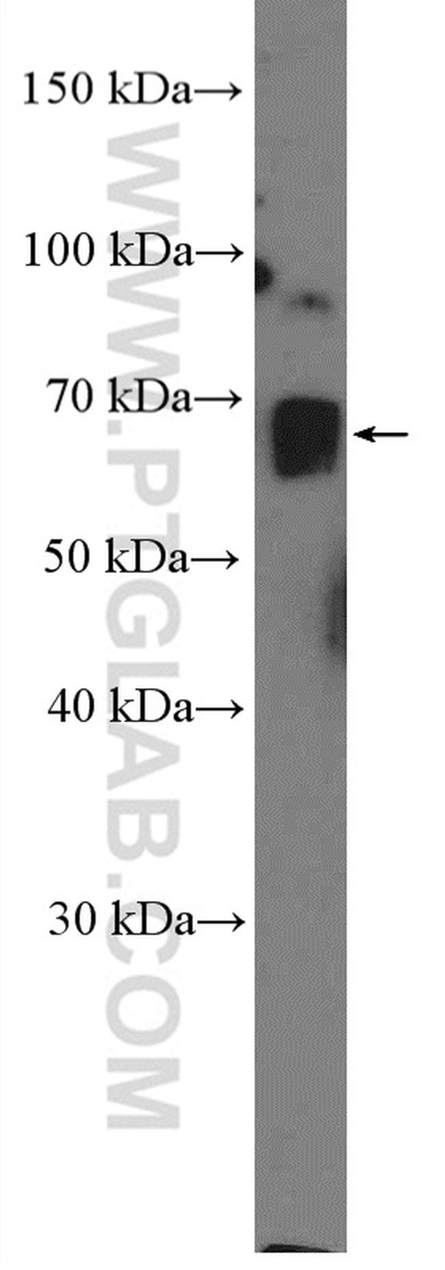 CRTC3 Antibody in Western Blot (WB)