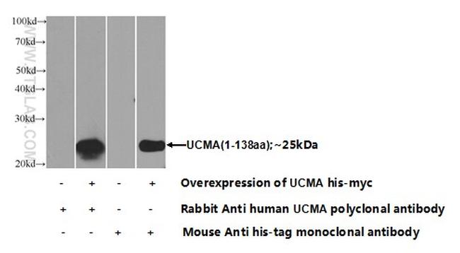 UCMA Antibody in Western Blot (WB)