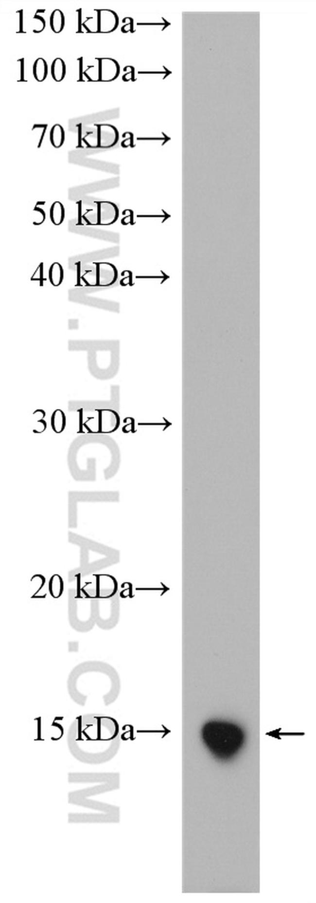 UCMA Antibody in Western Blot (WB)