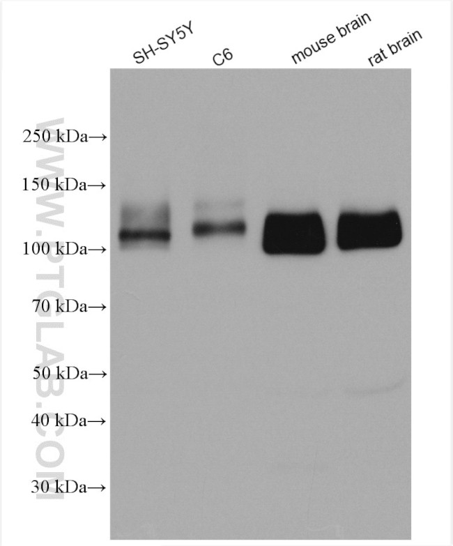 beta Amyloid (C-Terminal) Antibody in Western Blot (WB)