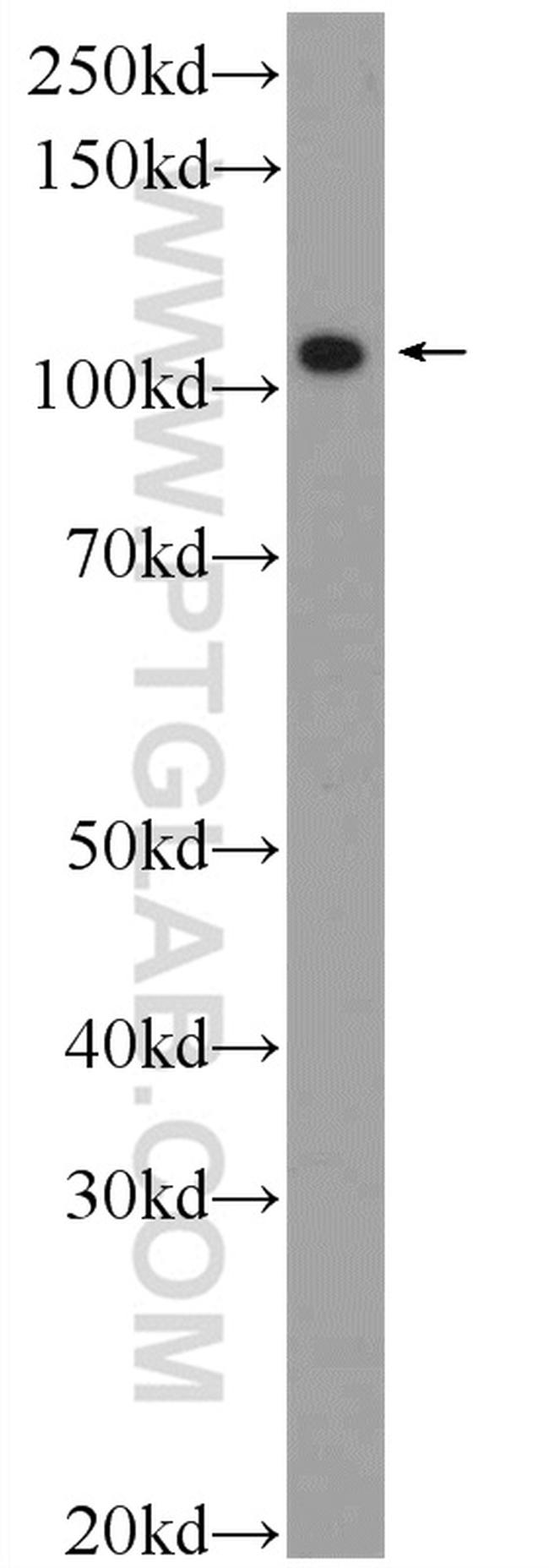 FSD2 Antibody in Western Blot (WB)