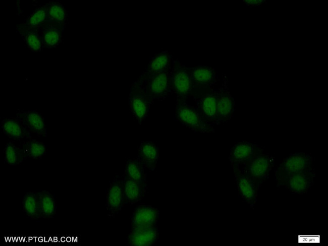 ZBTB25 Antibody in Immunocytochemistry (ICC/IF)